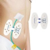 Disposable Biliary Drainage Fixation Tube Device Middle Buckle Catheter Stabilizer Holder Adhesive Tube Fixation