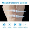 Zip Tie Sutures Painless Skin Wound Closure Device